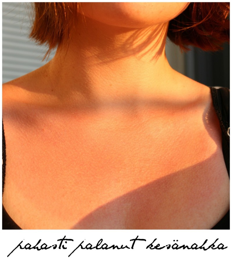 Punaiset hiukset auringonvalossa - Omakotivalkoinen